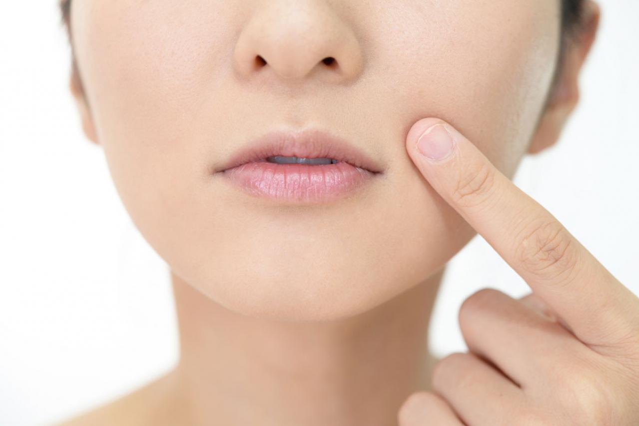 本気の【シミ】対策に！５0代から始める美容医療の基礎知識。【シミ編】