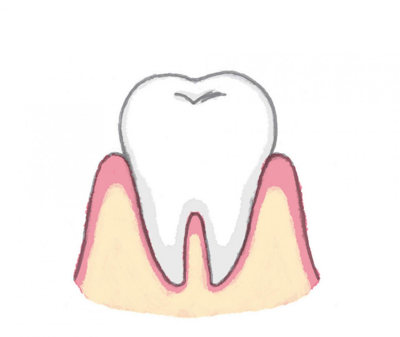 「ハグキが下がってきた」の悩みは加齢のせい？ あまり知られていない真実とは？（画像3）