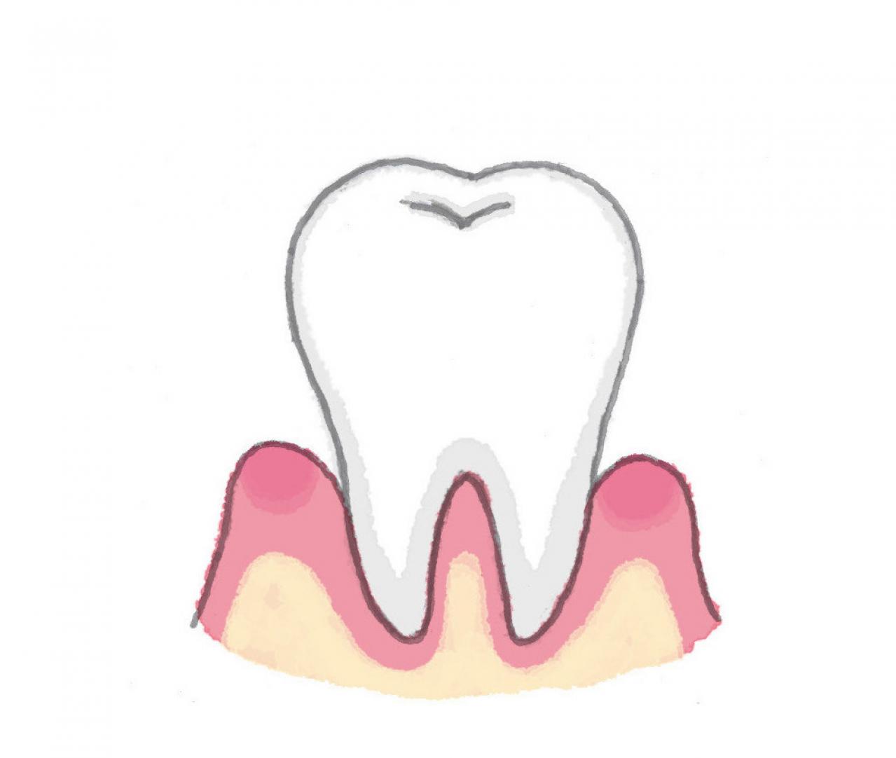 「ハグキが下がってきた」の悩みは加齢のせい？ あまり知られていない真実とは？（画像4）
