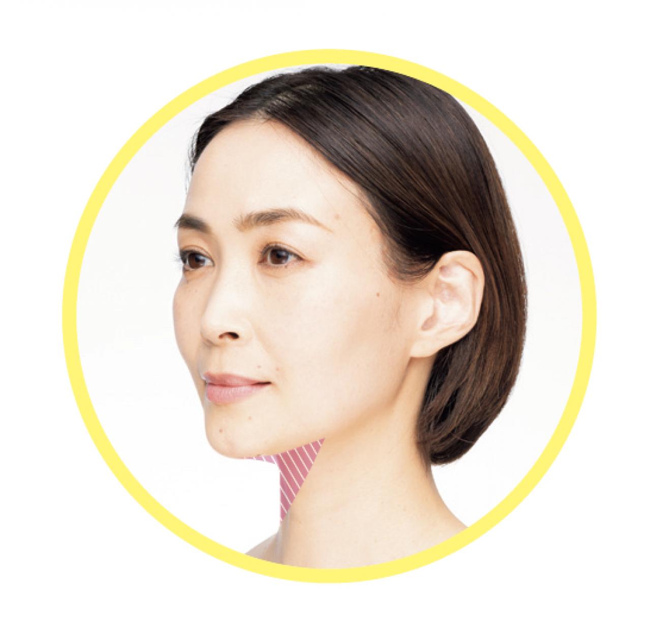 【口まわりリフト】で二重あごがすっきり！ 村木宏衣さんの「奇跡のたるみリフト」（画像2）