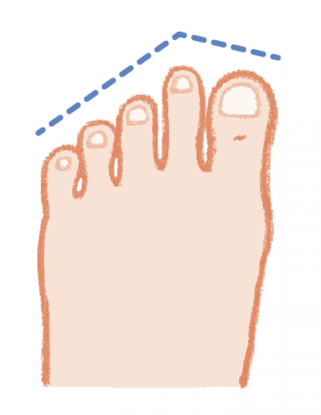ヒールの高さは何センチがよい？足の健康寿命を延ばす【靴の選び方】専門医がアドバイス（画像5）