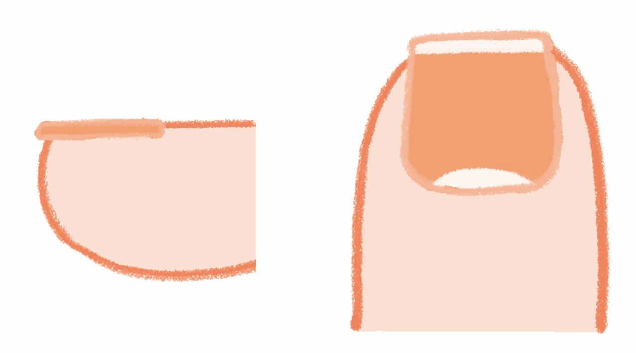 健康寿命を延ばす【歩行速度】とは？ 足の専門医がアドバイス（画像7）