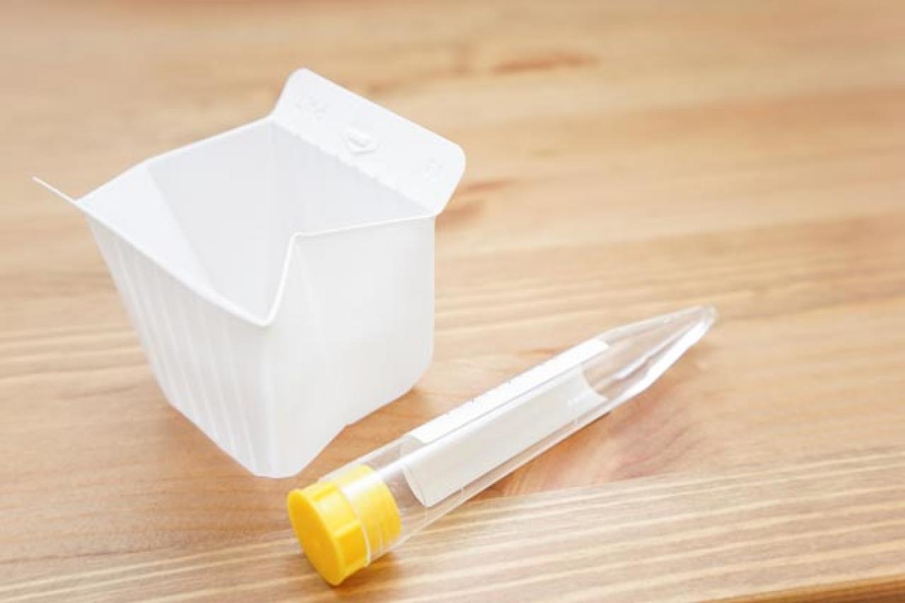 頻尿・尿漏れで受診するときは、どんなことに気をつけたらいい？　医師がアドバイス（画像2）