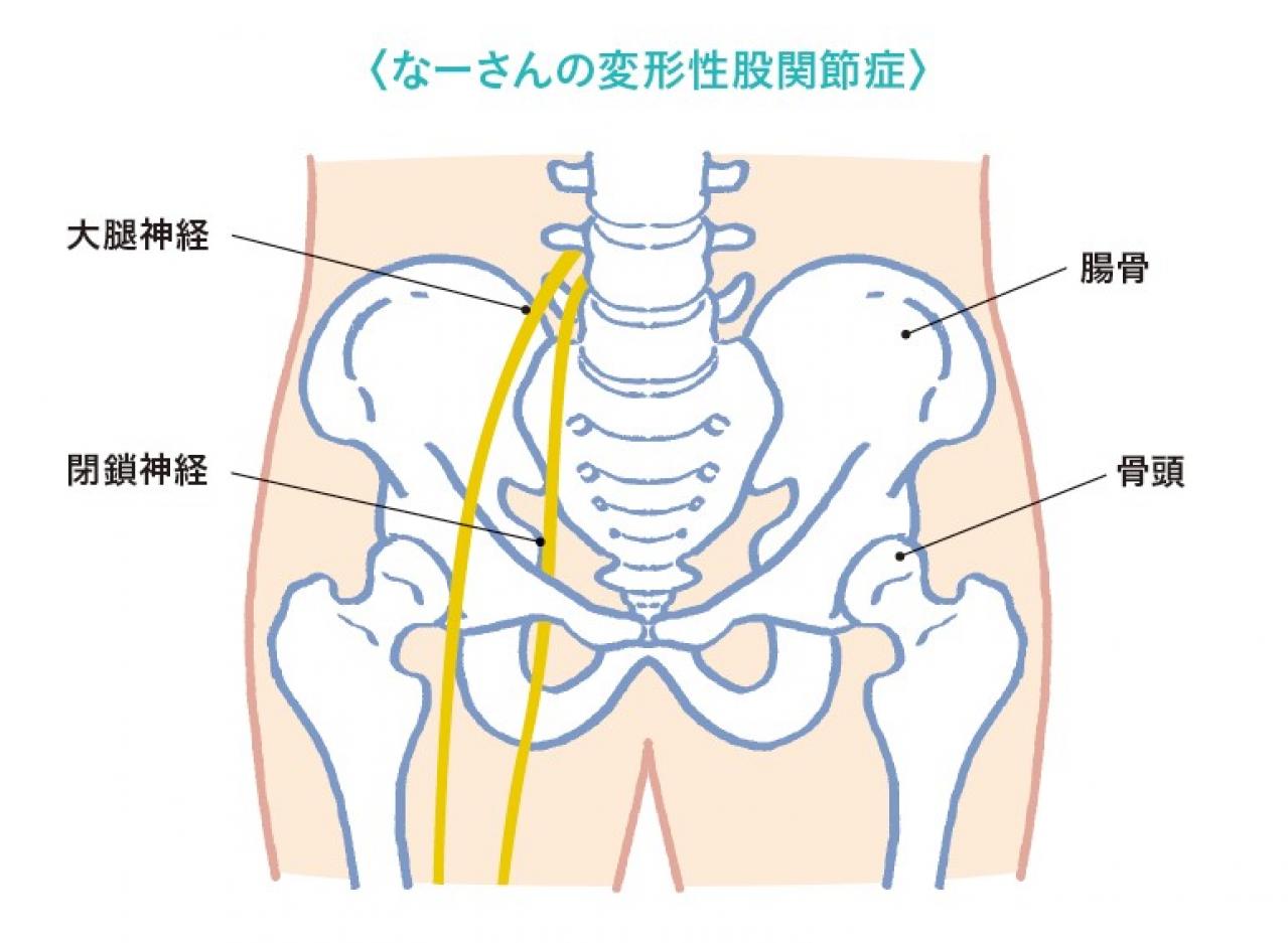 兼子ただしさんが語る、「股関節の痛み」で歩くことさえ困難だった45歳女性。スタスタ歩けるようになった「神経系ストレッチ」とは!?（画像3）