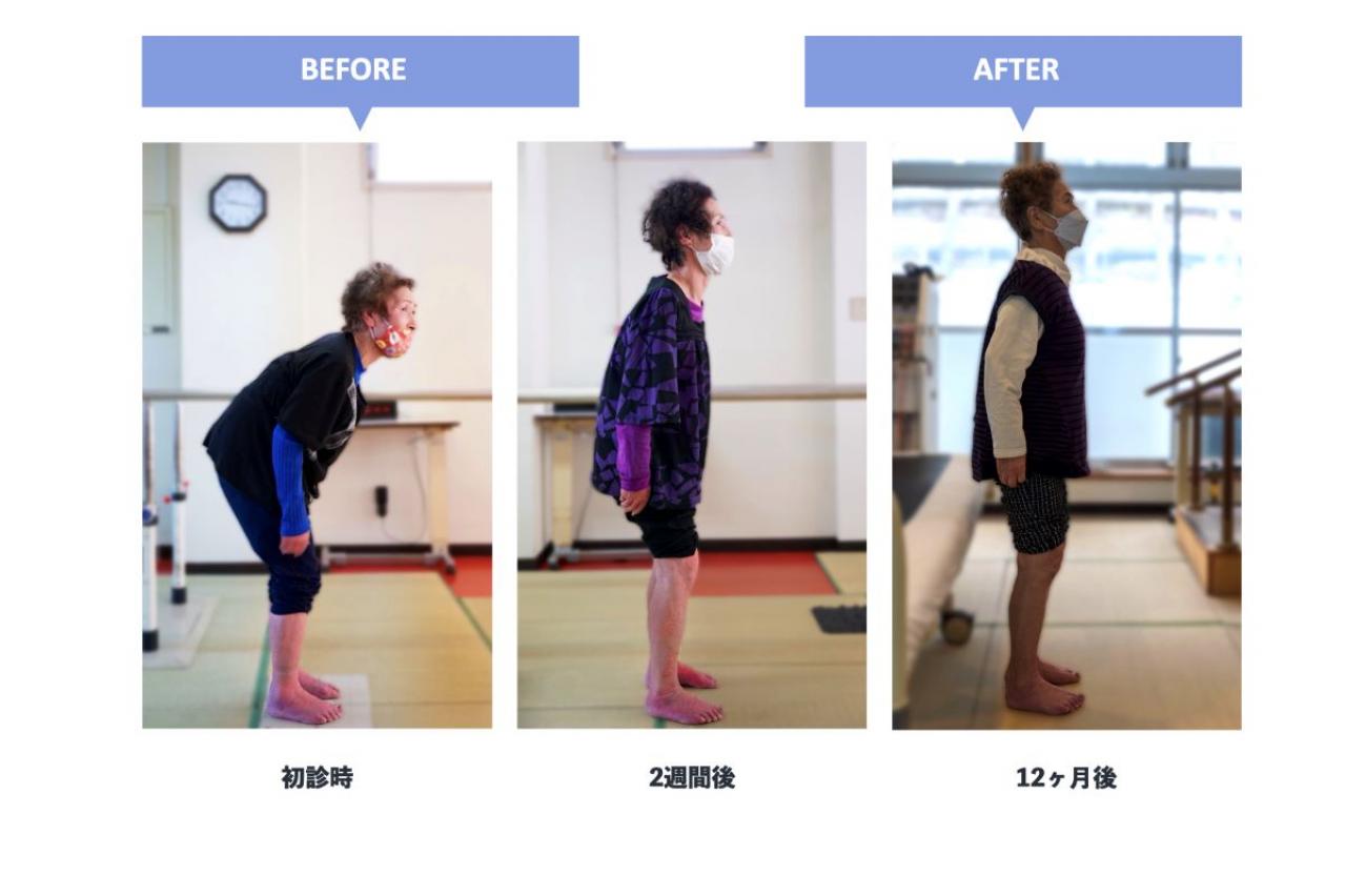 「妻のO脚を治したい！」理学療法士が開発した【5本指ソックス】その実力を編集部がレポート！（画像4）