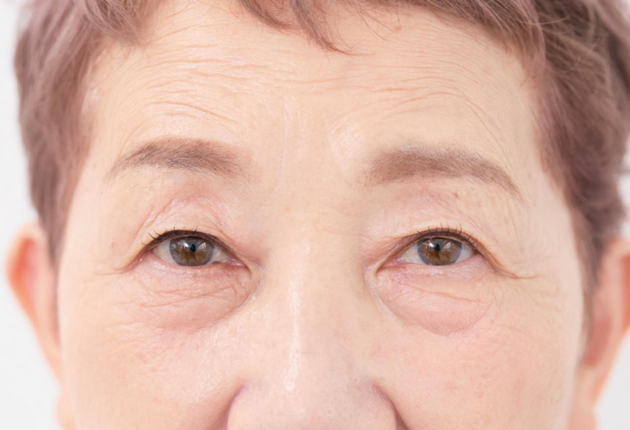70代の【まぶたのたるみ】を補正する100均アイテムも！ ヘアメイク職人【化け子さん】おすすめ（画像5）