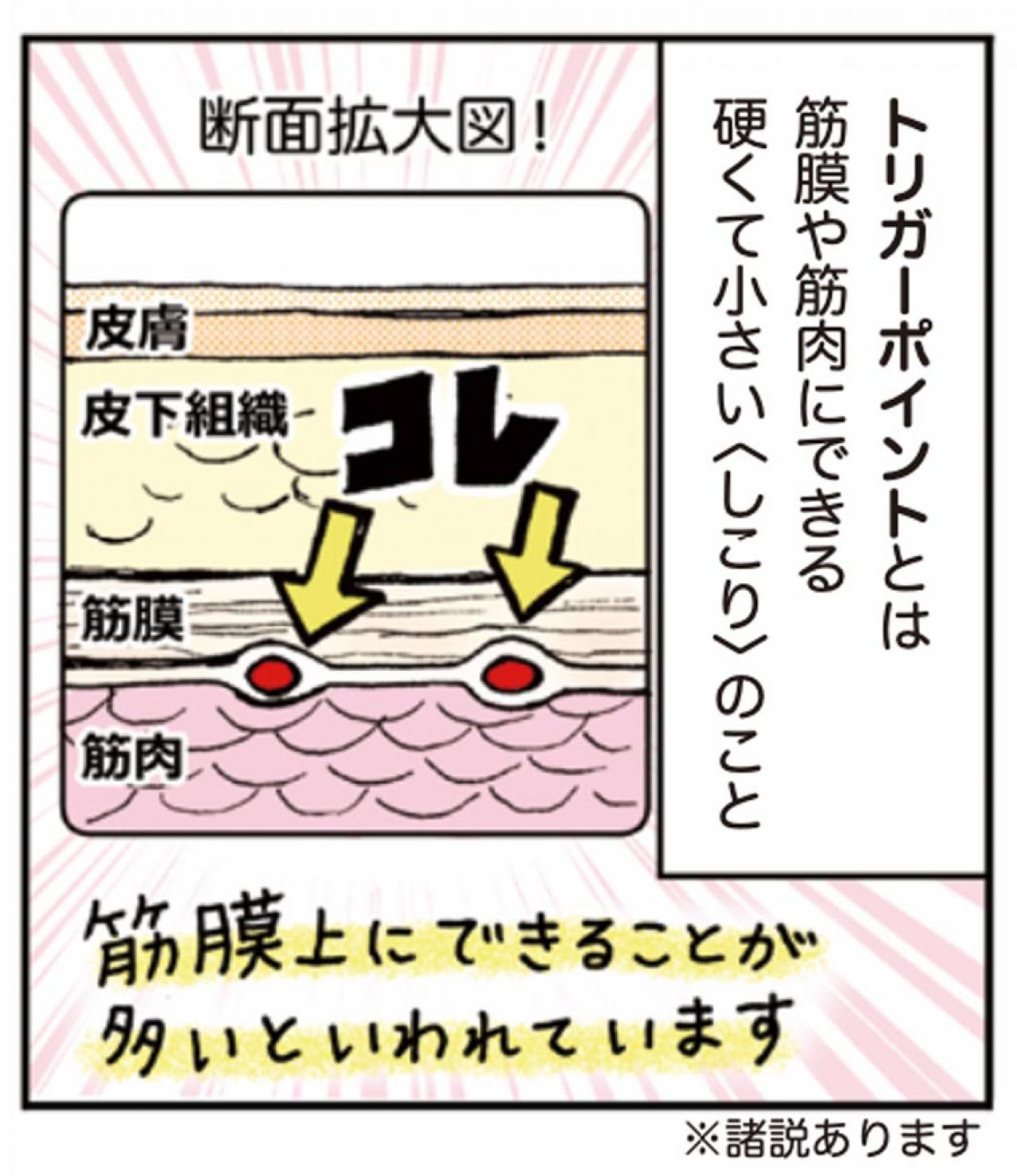 超ほぐれる「トリガーポイント」って一体何？肩こり・息苦しさのお悩みに【マンガでセルフケア】（画像3）