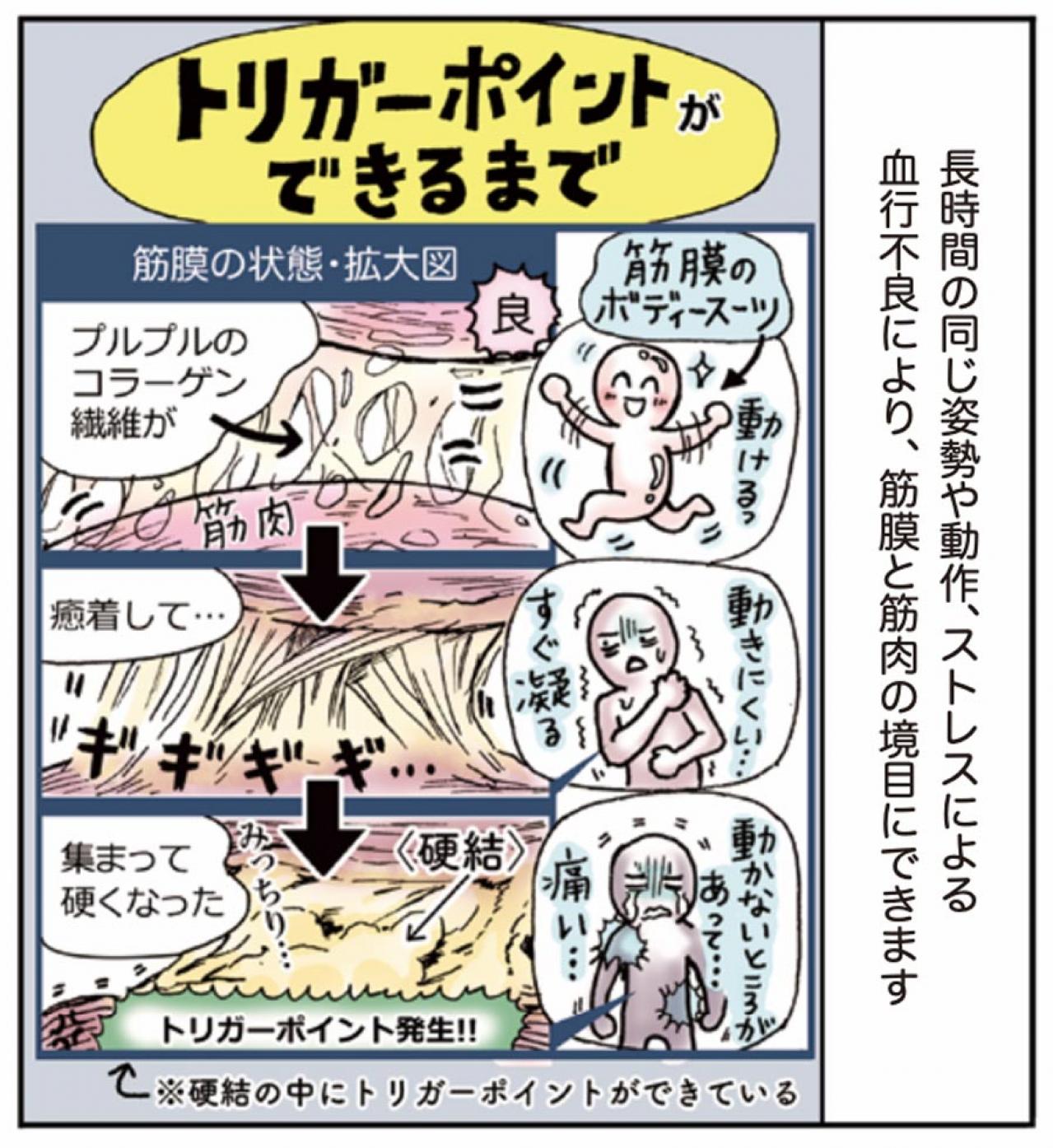 超ほぐれる「トリガーポイント」って一体何？肩こり・息苦しさのお悩みに【マンガでセルフケア】（画像8）