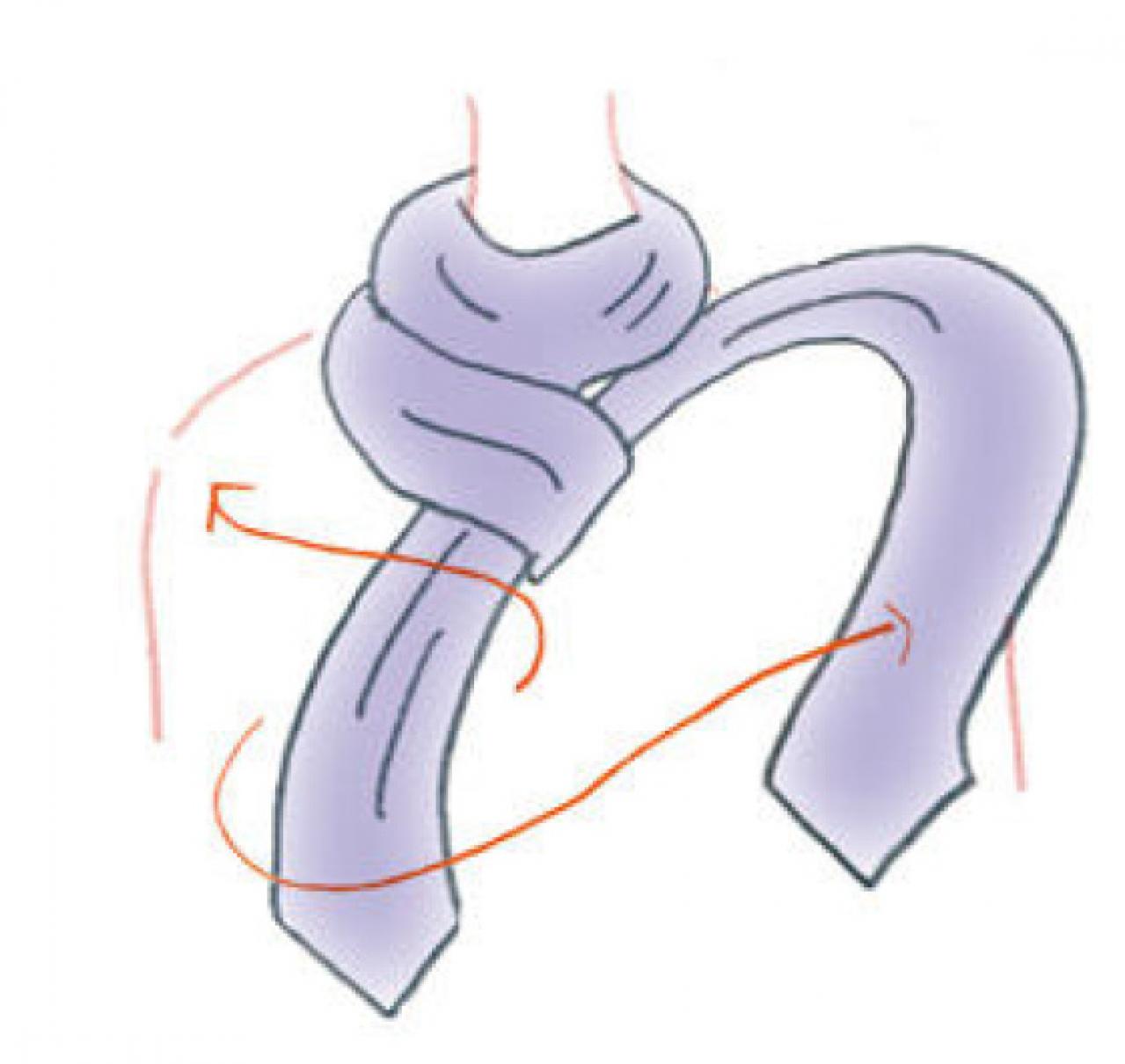 きちんとした人に見える【スカーフの巻き方】柄も生かせる「ネックタイト」（画像8）