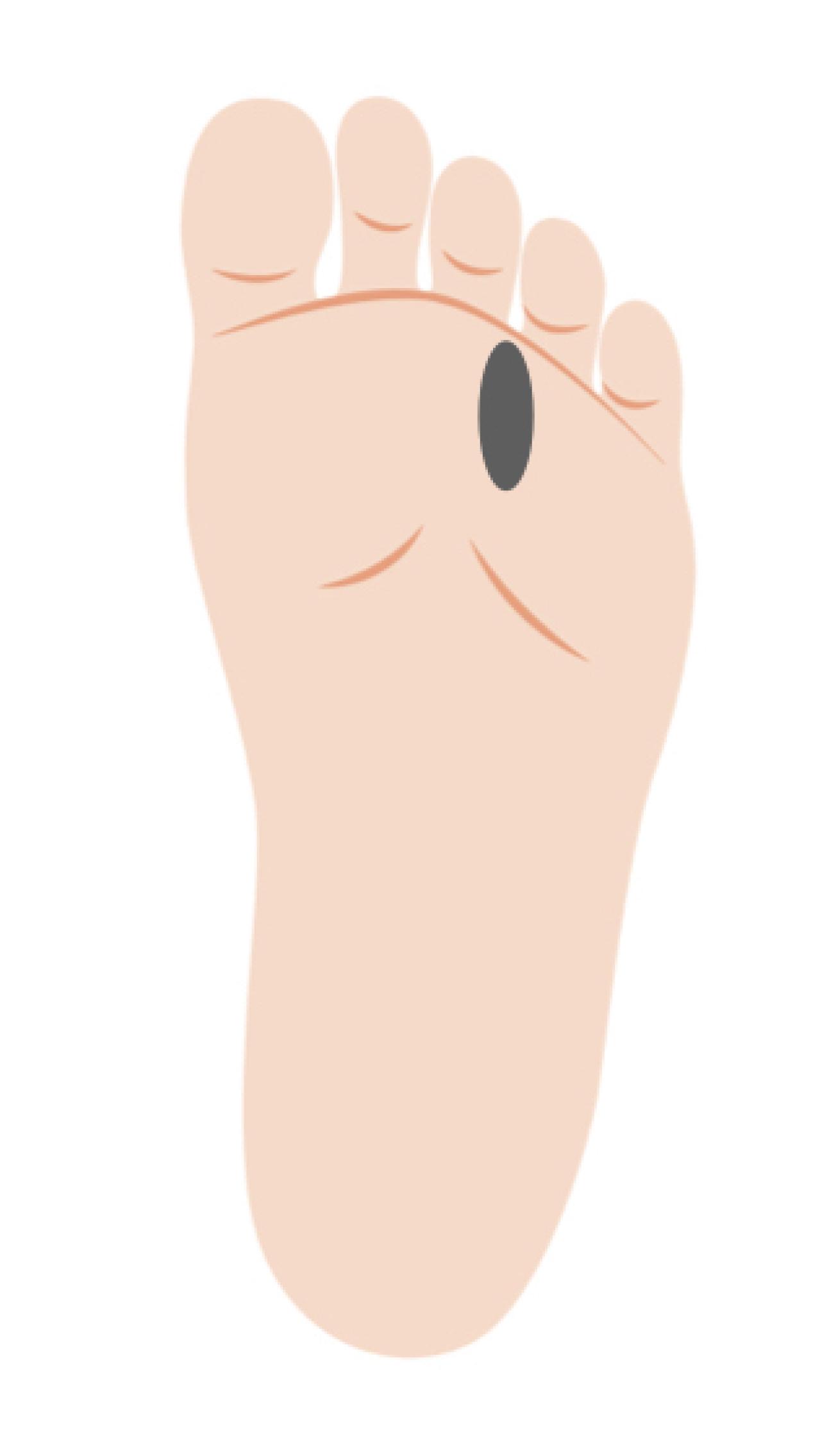 「その足放置していたらマズイかも…」足トラブルの危険度をチェック！セルフケア方法も（画像10）