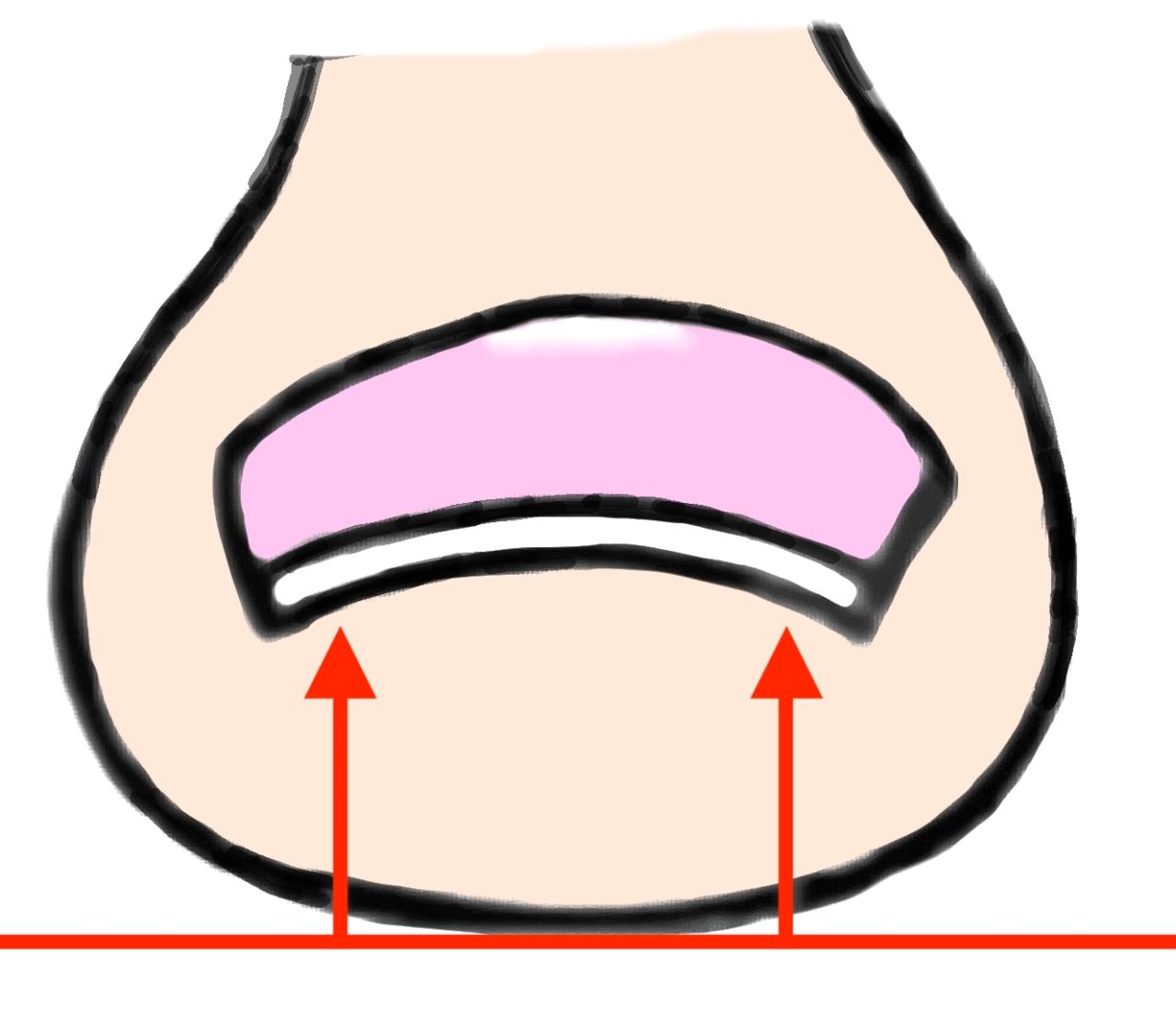 【巻き爪】の原因は実は爪じゃなかった…！ヒールのある靴をよく履く人が注意すべきことも（画像5）