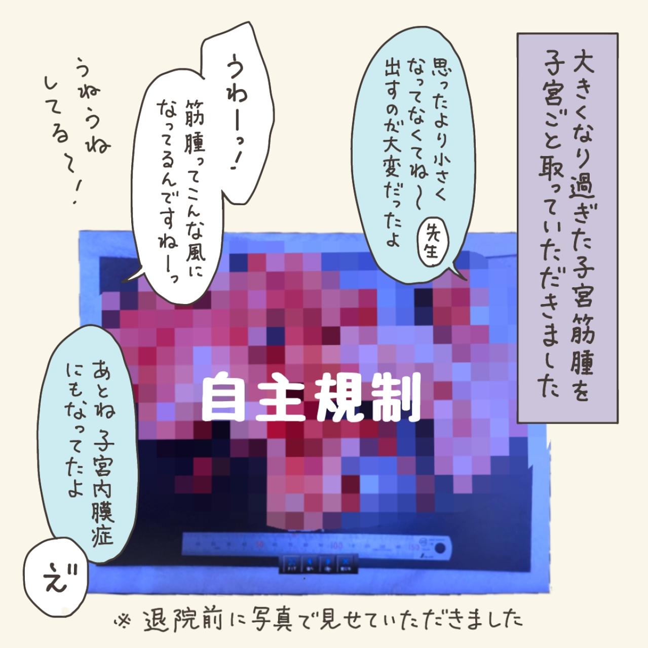 きっかけは、40代になり久々に受けた健康診断だった！【実録！40代婦人科トラブル＃1】（画像4）