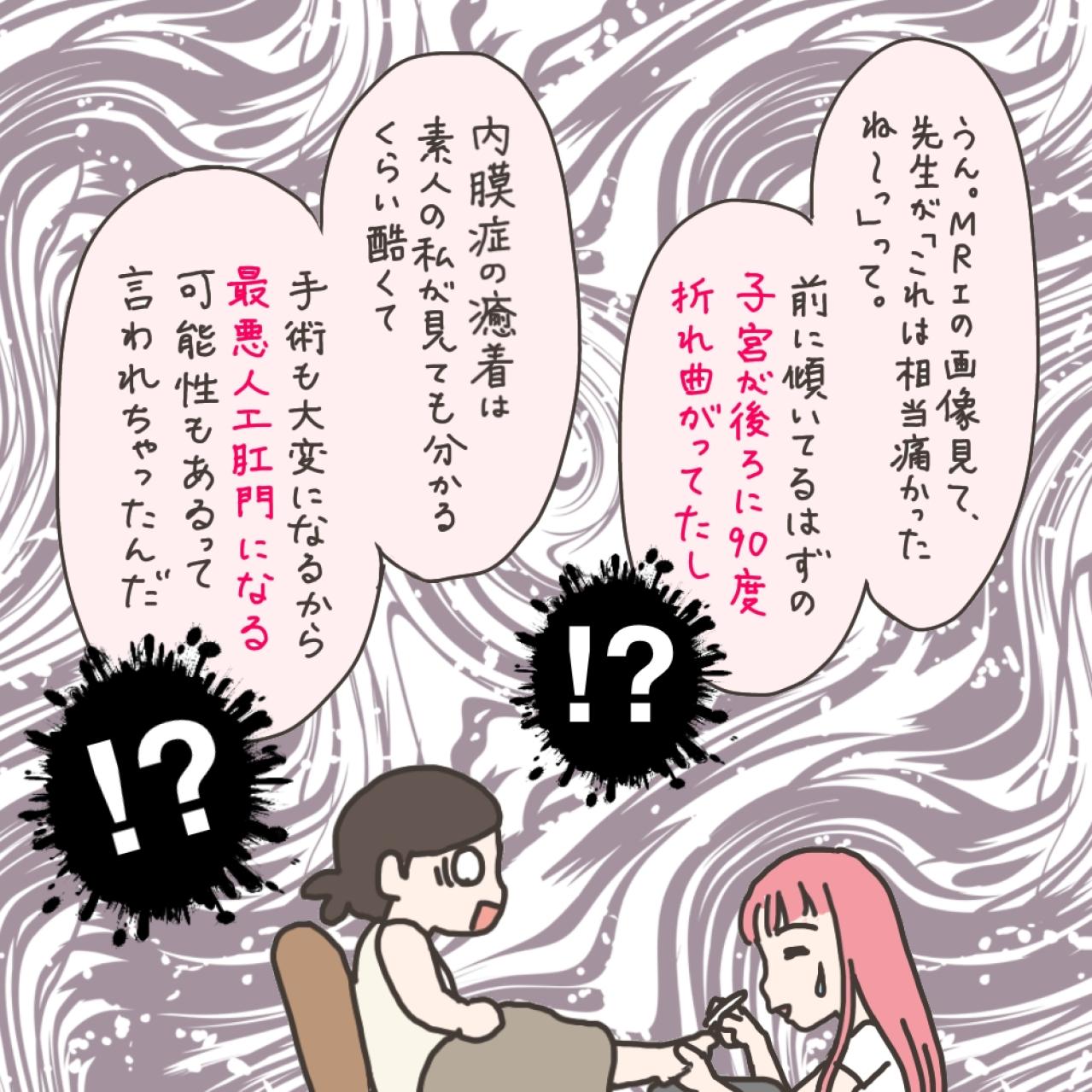ママ友の話を聞いて婦人科へ…筋腫の大きさはどのぐらいになっていた？【実録！40代婦人科トラブル＃7】（画像7）