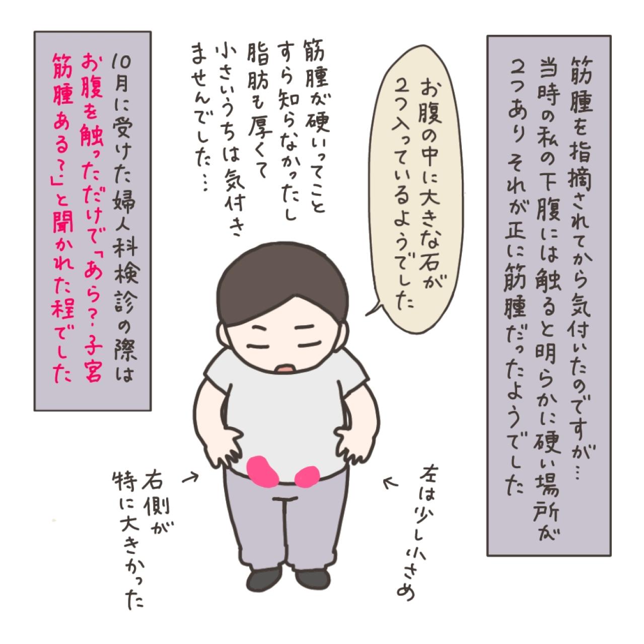 治療を後回しにしていたら…子宮筋腫の自覚症状はどんなの？【実録！40代婦人科トラブル＃6】（画像6）