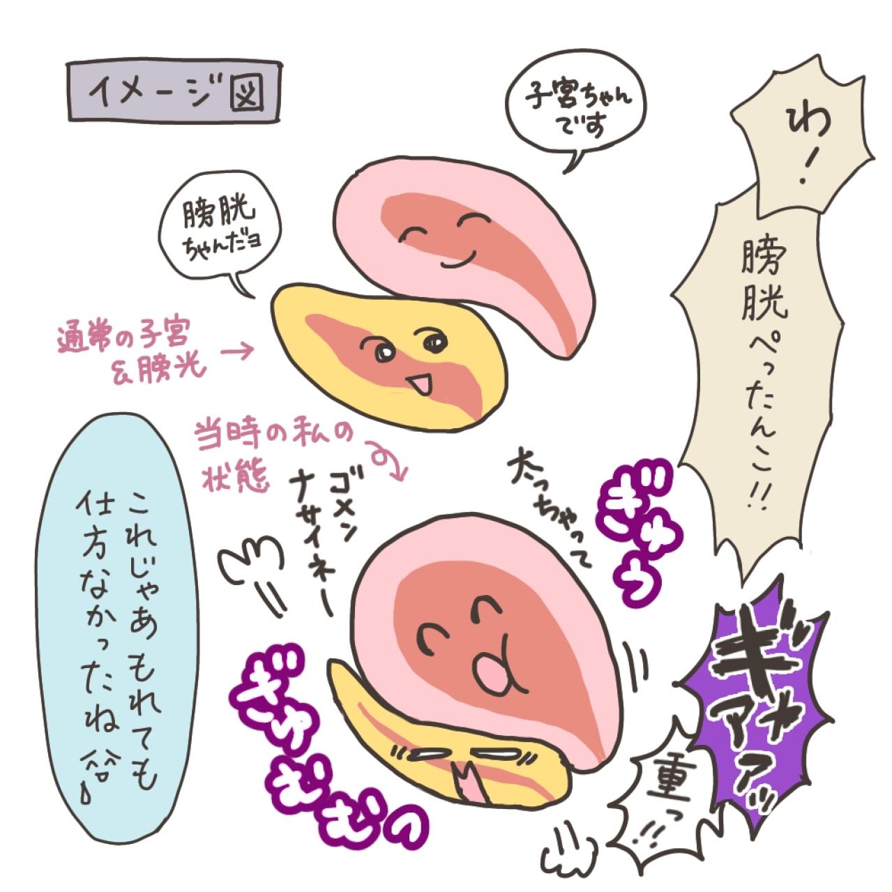 MRI撮影…子宮筋腫の大きさは？【実録！40代婦人科トラブル＃14】（画像16）