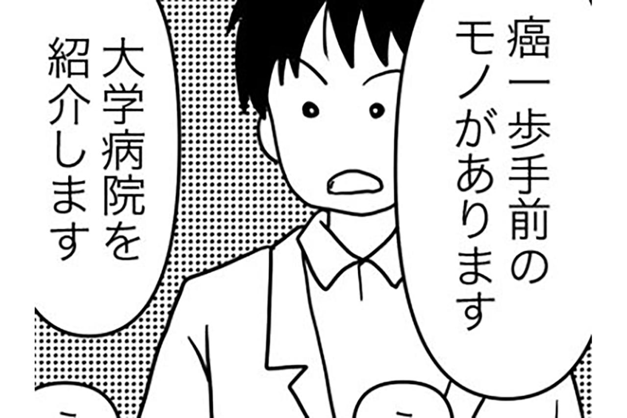 「がん一歩手前」ってどういうこと？いざ大学病院へ…【乳癌日記 #4】