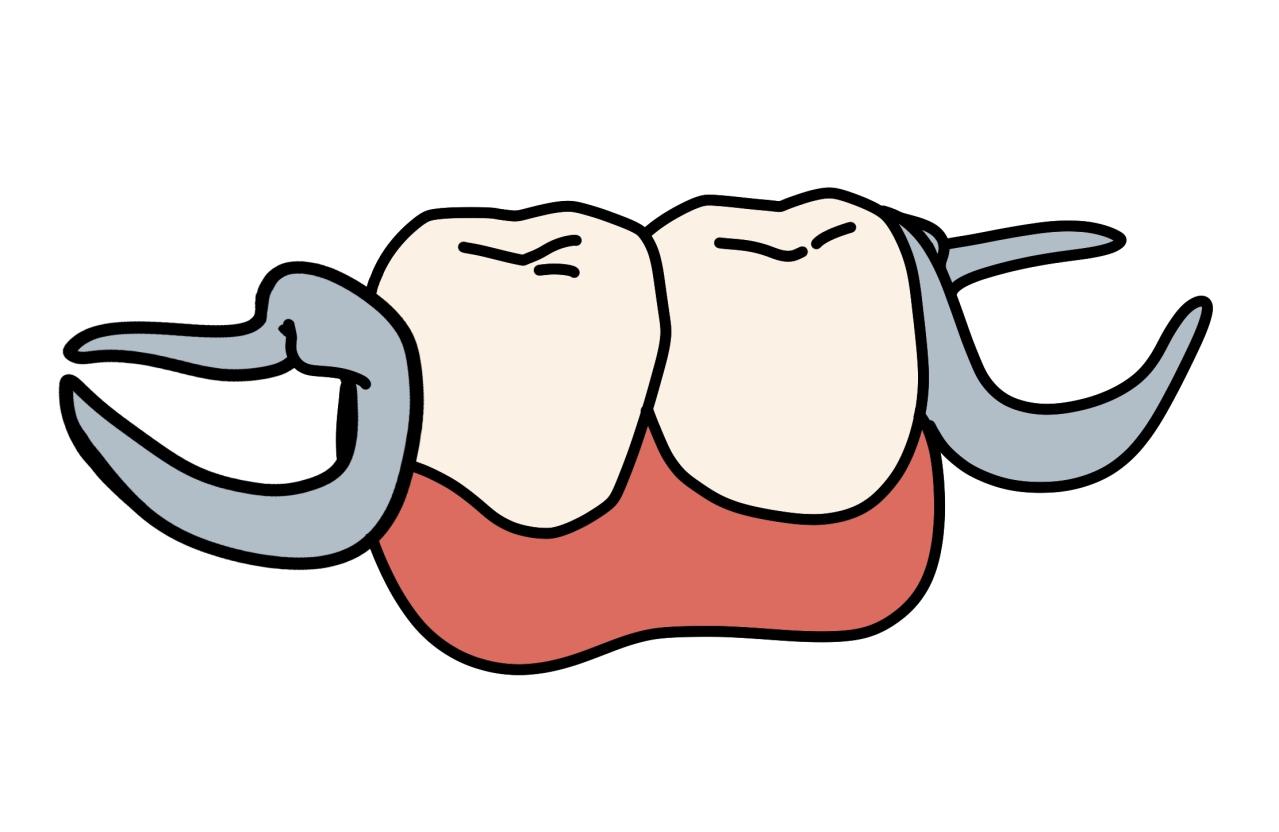 【50代からの歯のお手入れ】歯を失ったら…？医師が解説する「インプラントOKな場合とNGな場合」（画像5）