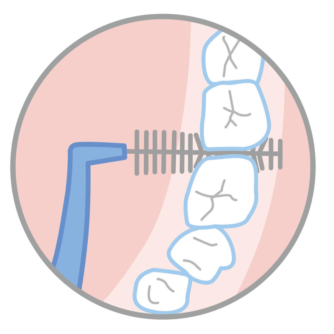シニア専門の歯科医がすすめる【正しい歯の磨き方】歯ブラシ時間は何分？歯間ブラシは毎回やるべき？徹底解説（画像7）