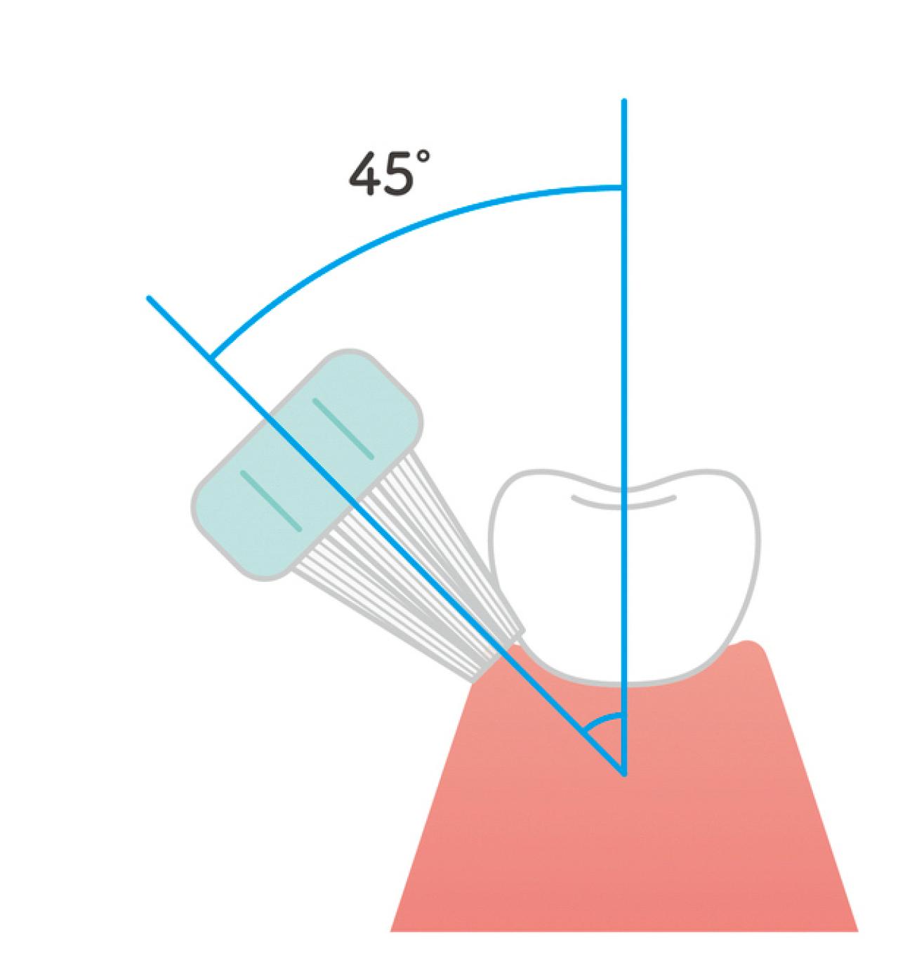 シニア専門の歯科医がすすめる【正しい歯の磨き方】歯ブラシ時間は何分？歯間ブラシは毎回やるべき？徹底解説（画像4）
