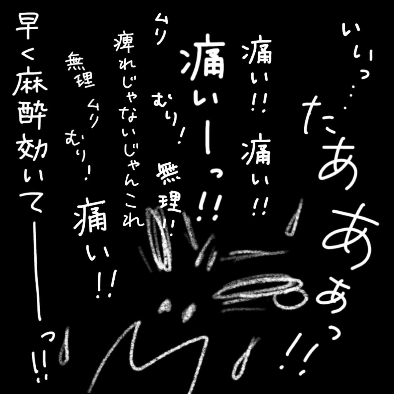 いざ！手術室入室。様子は？痛みは？【実録！40代婦人科トラブル＃34】（画像15）