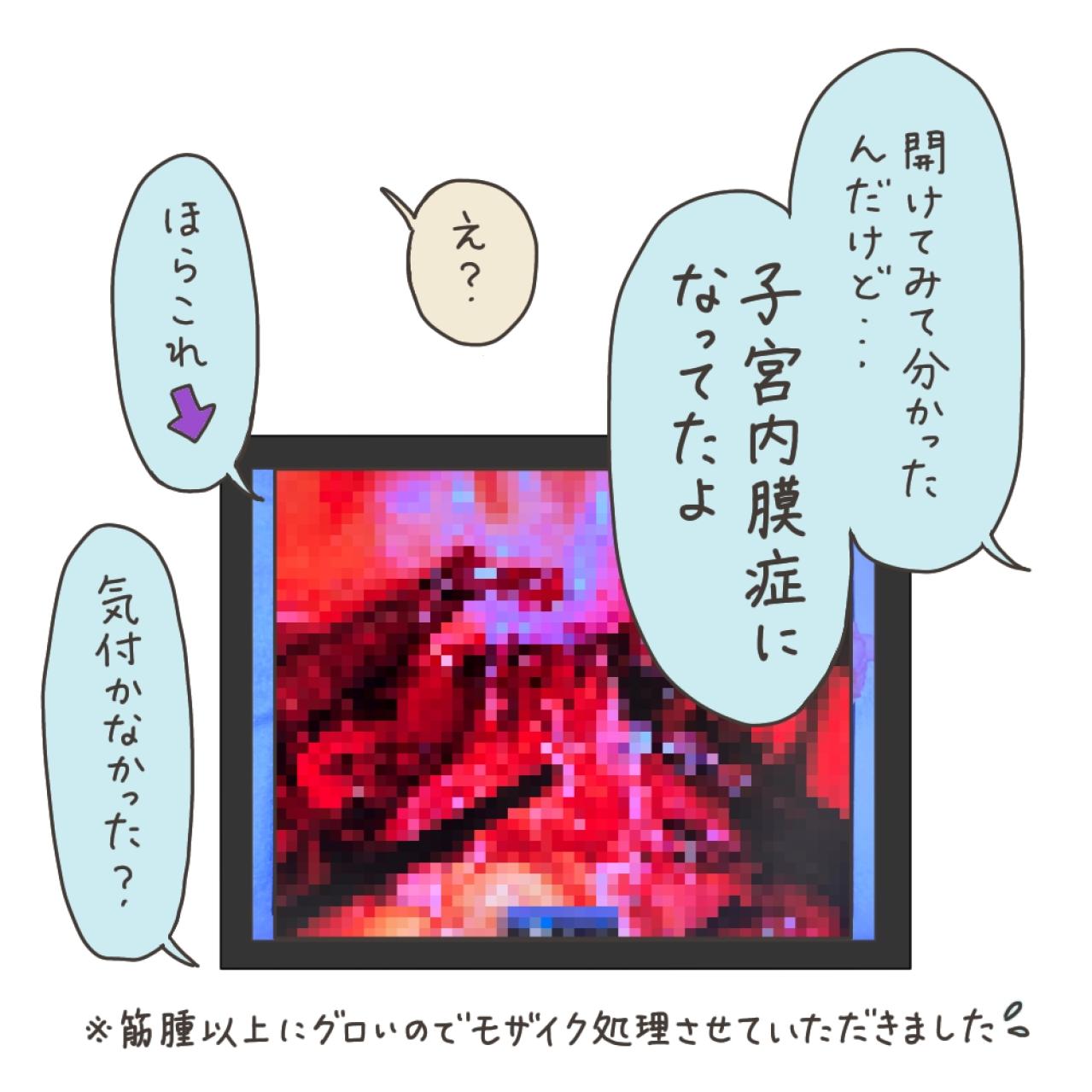 薬で筋腫は小さくなっていなかった！薬が効いていたように思えた理由は？【実録！40代婦人科トラブル＃46】（画像14）