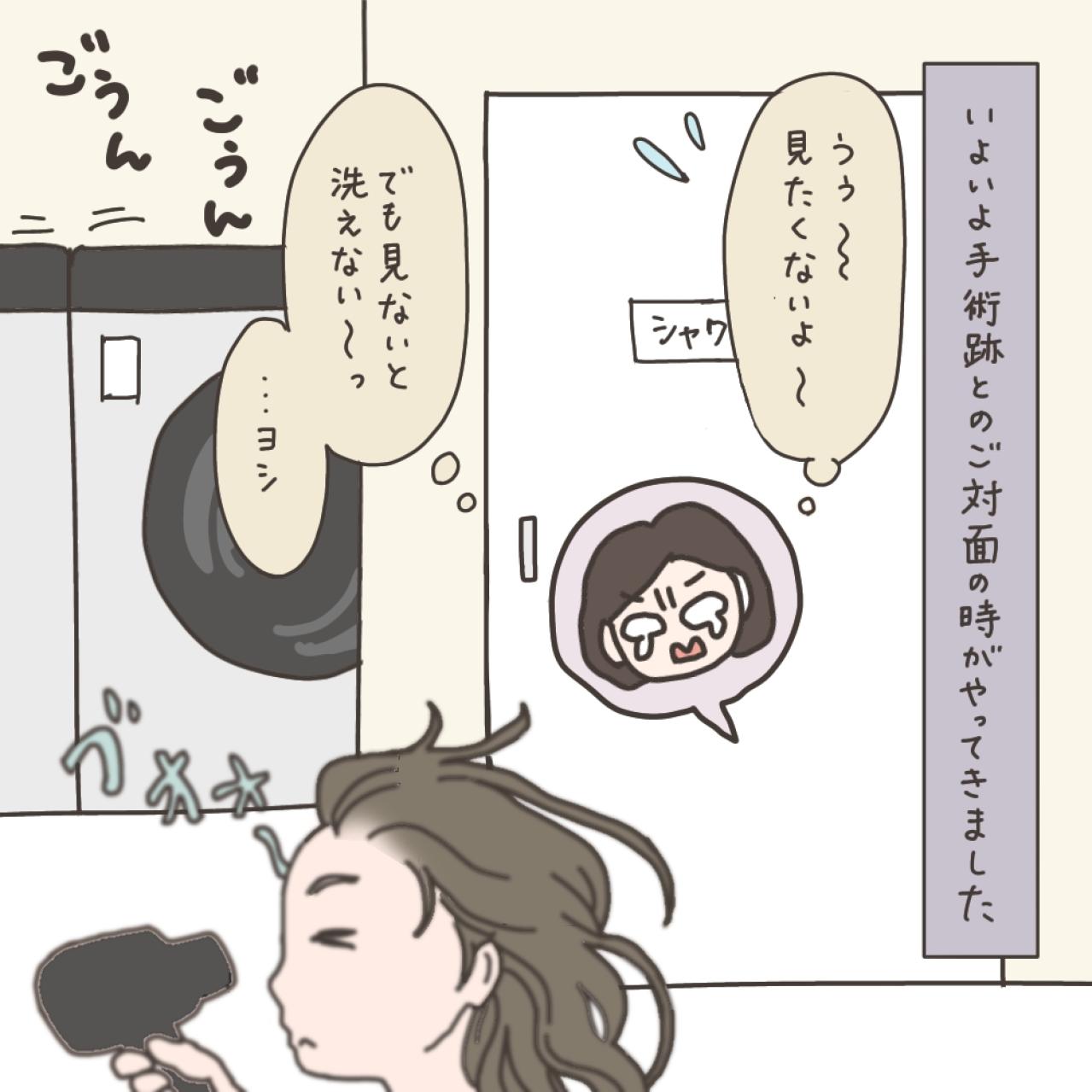 子宮全摘の手術2日後…気になるシャワー浴。傷口は大丈夫？【実録！40代婦人科トラブル＃41】（画像9）