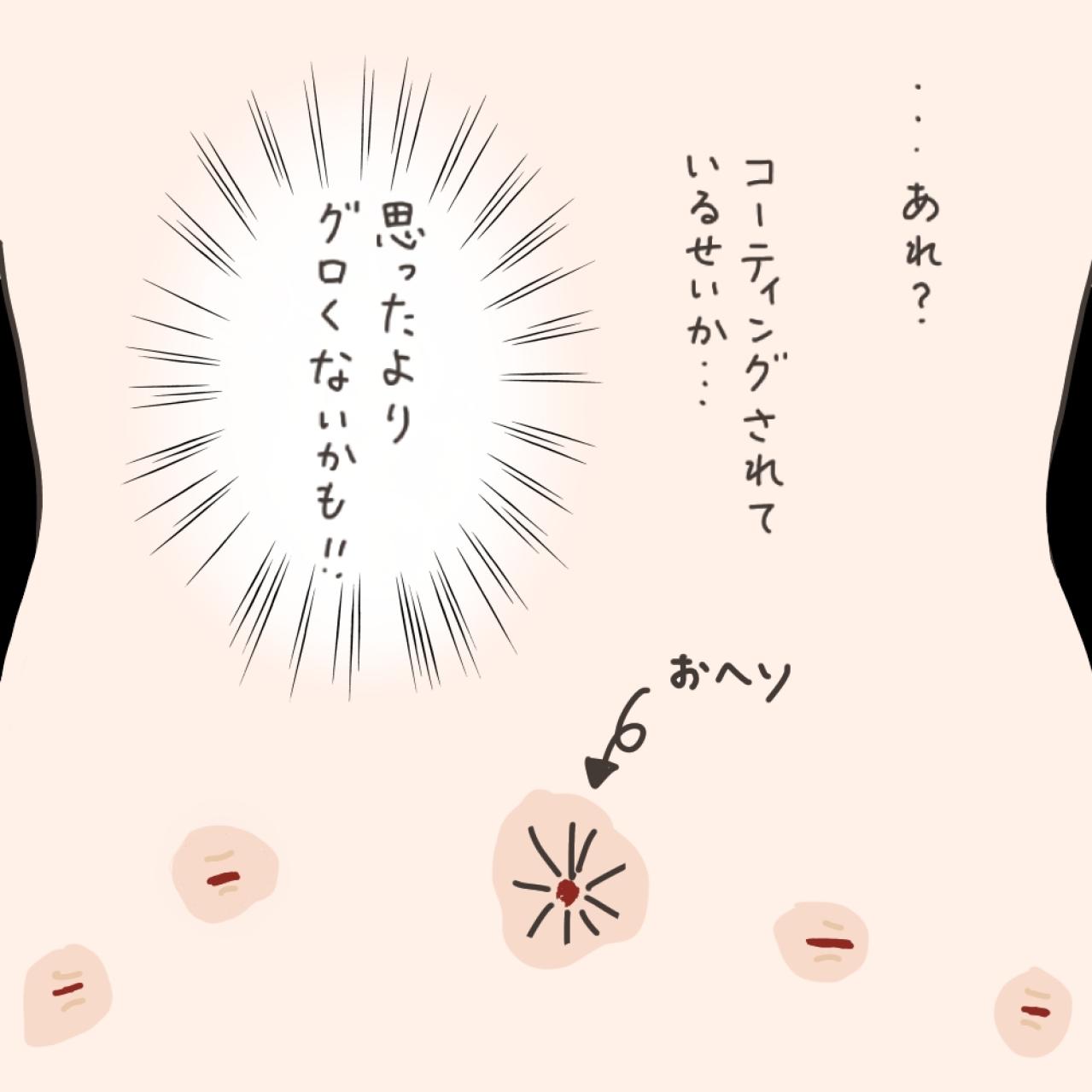 子宮全摘の手術2日後…気になるシャワー浴。傷口は大丈夫？【実録！40代婦人科トラブル＃41】（画像11）