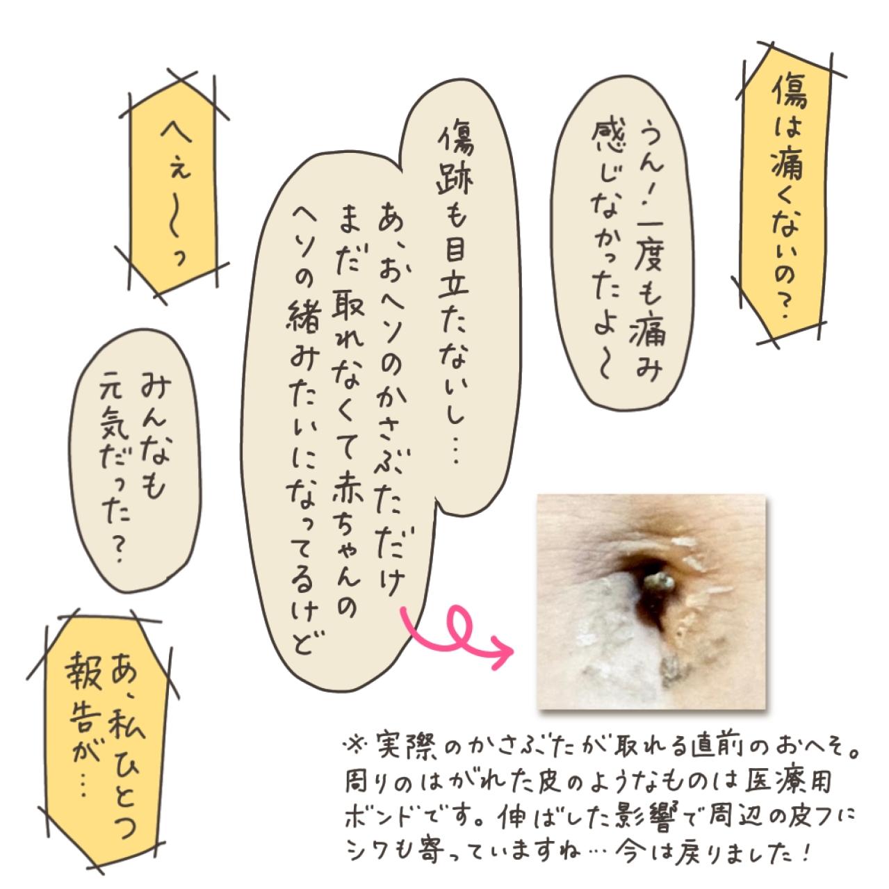【最終回】子宮全摘手術から1年半…悩みに悩んで全摘した感想は？【実録！40代婦人科トラブル＃51】（画像5）