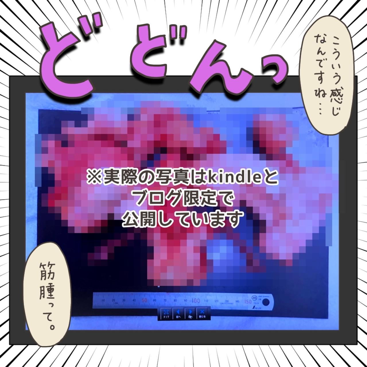 薬で筋腫は小さくなっていなかった！薬が効いていたように思えた理由は？【実録！40代婦人科トラブル＃46】（画像12）