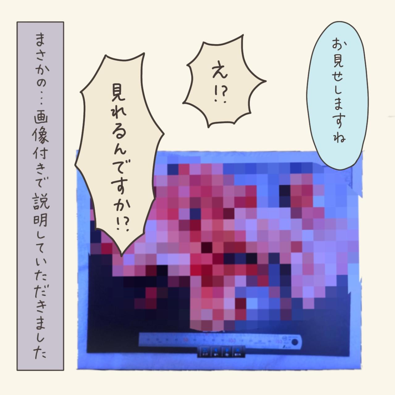 薬で筋腫は小さくなっていなかった！薬が効いていたように思えた理由は？【実録！40代婦人科トラブル＃46】（画像7）