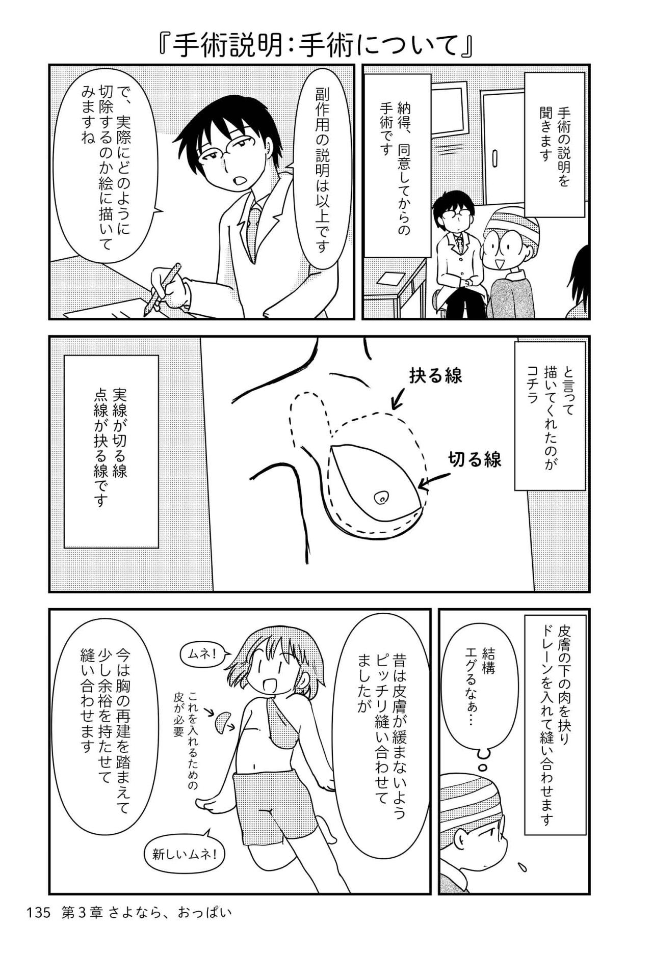 胸の全摘手術・今昔。今と昔で変わったことは？【乳癌日記 #54】（画像3）