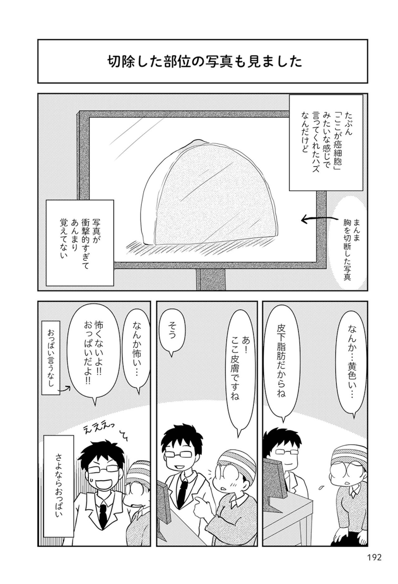 右胸摘出手術で切除したおっぱいを見た感想は…【乳癌日記 #81】（画像3）