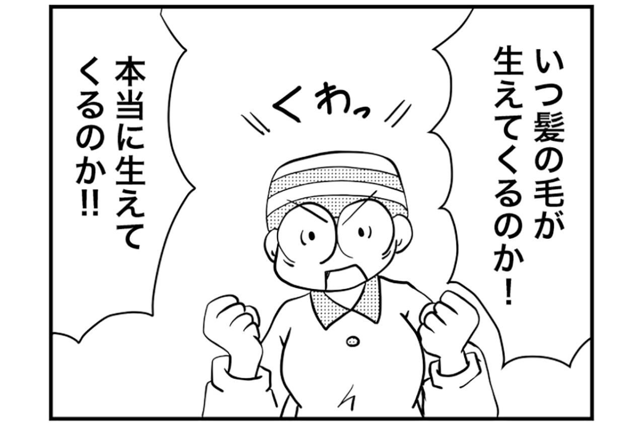 抗がん剤副作用の脱毛。髪が再び生えるタイミングはいつごろ？【乳癌日記 #96】