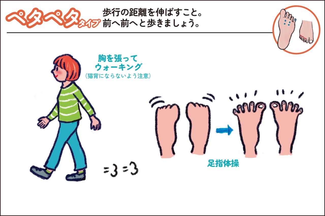 【足連載／第２歩】タコ1つでも要注意!? 知らないと損する足裏からわかる４つのタイプ別対策法（画像6）