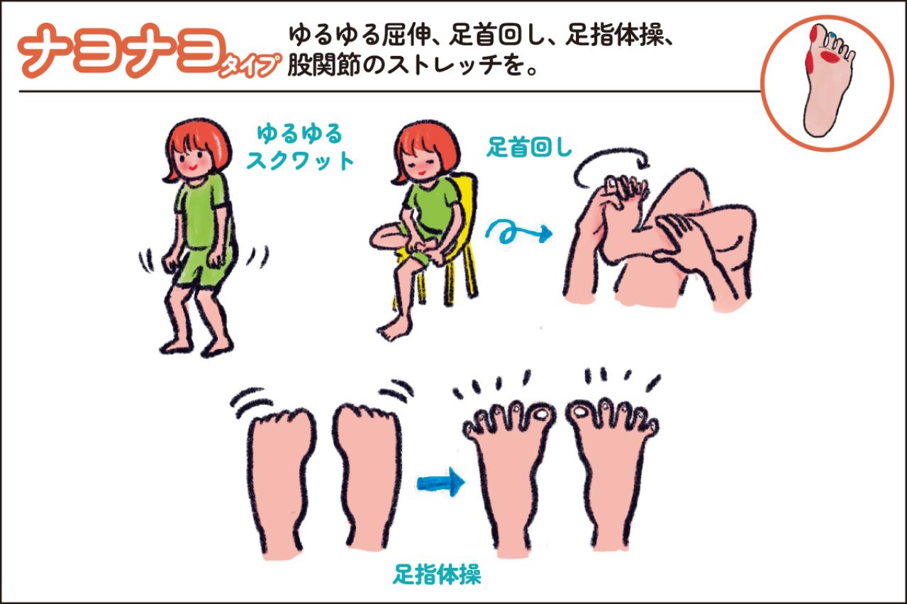 【足連載／第２歩】タコ1つでも要注意!? 知らないと損する足裏からわかる４つのタイプ別対策法（画像3）