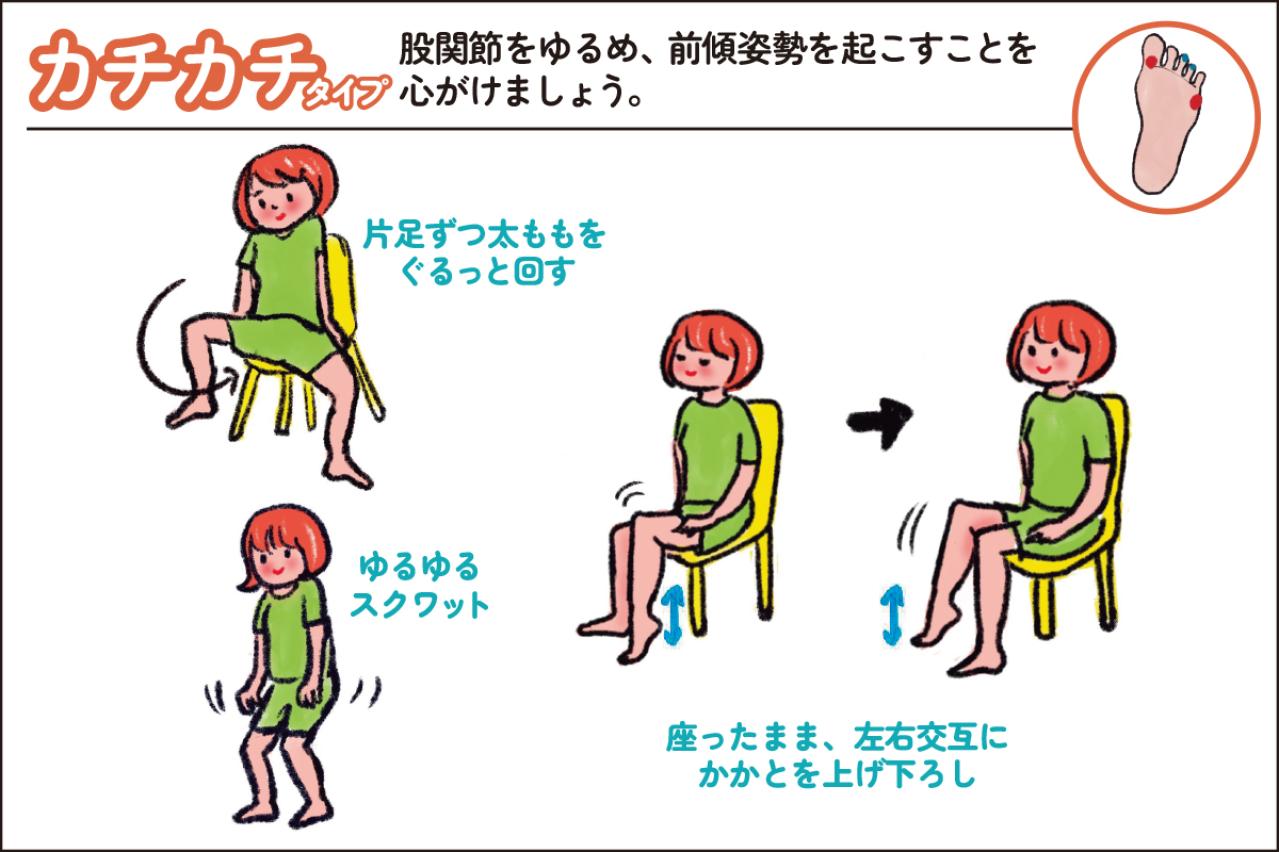 【足連載／第２歩】タコ1つでも要注意!? 知らないと損する足裏からわかる４つのタイプ別対策法（画像5）