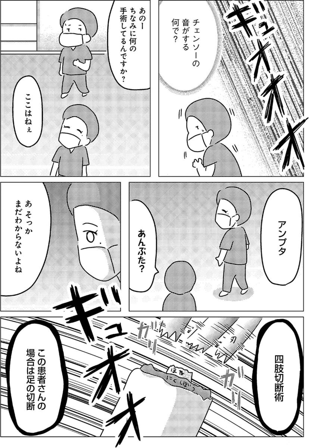 ドラマの手術室とは違った――焦げた匂いとチェーンソーの音【手術室の中で働いています。 #8】（画像4）