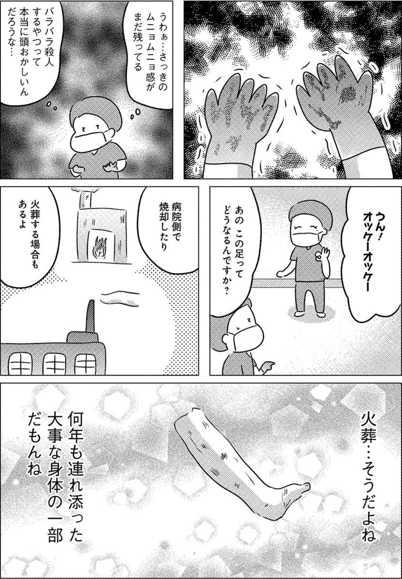 重く、異臭のする“足”。それでも大切な身体の一部【手術室の中で働いています。 #10】（画像5）