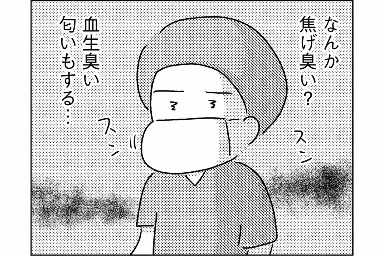 ドラマの手術室とは違った――焦げた匂いとチェーンソーの音【手術室の中で働いています。 #8】