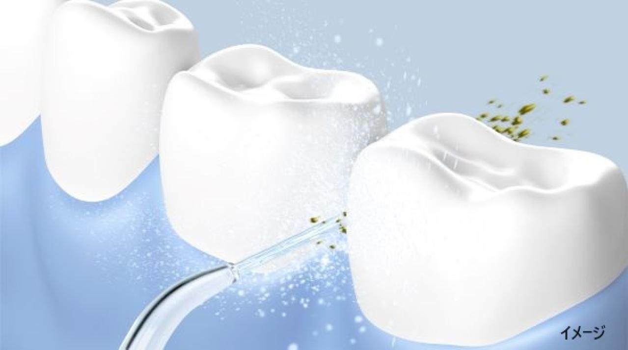 歯科医師監修「CLEARLABO」　口腔洗浄器 ジェットウォッシャー（替えノズル3本付）日本製（画像2）