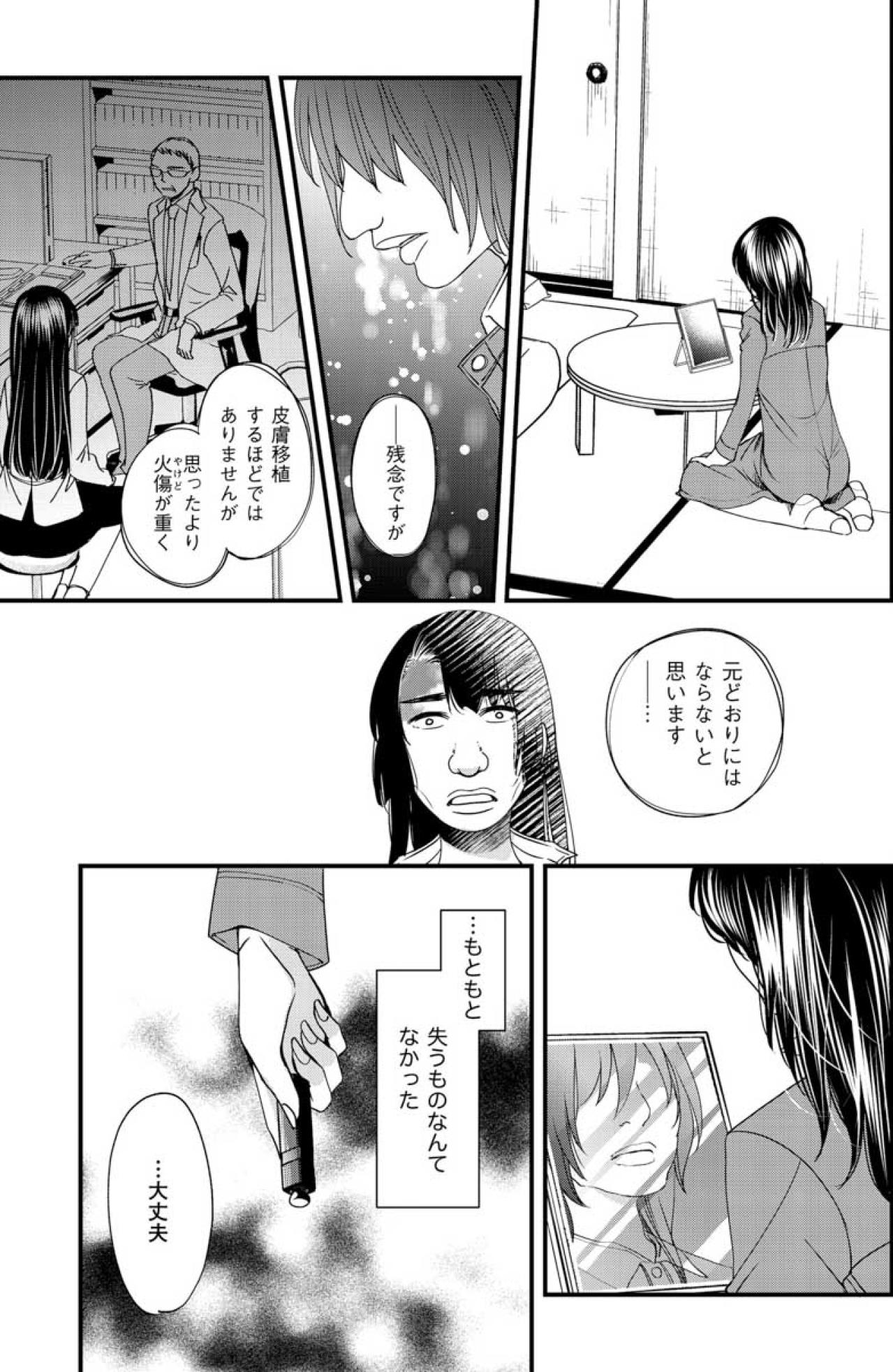 醜さを抱えたままでも人は生まれ変われる。顔に火傷を負っても夢子は立ち上がった【醜い私があなたになるまで #29】（画像2）