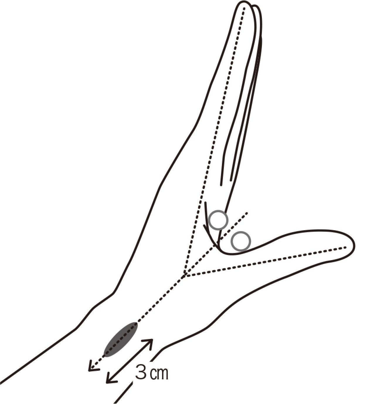 力を入れると、指がカクンと跳ね上がる！【ばね指】に効く「10秒神経マッサージ」とは？［医師が解説］（画像4）