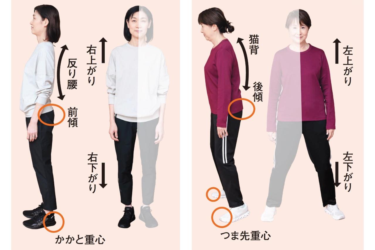 あなたは「うで体」or「あし体」？自分の体のクセがわかれば不調が改善！【鴻江理論】