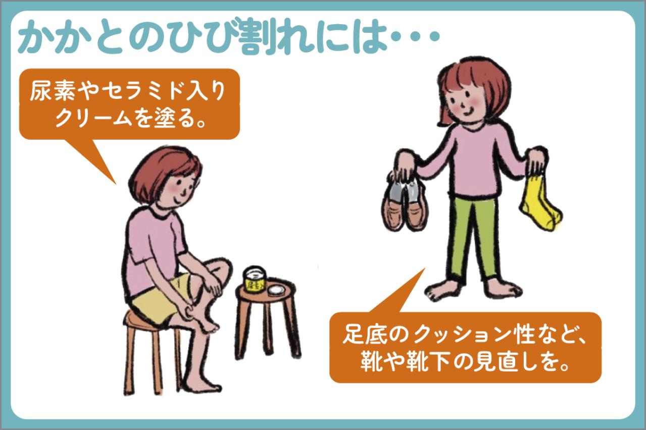 足の冷え、O脚、靴トラブルなど“足のお悩みあるある”に専門家が答えます【足連載／第５歩】（画像4）