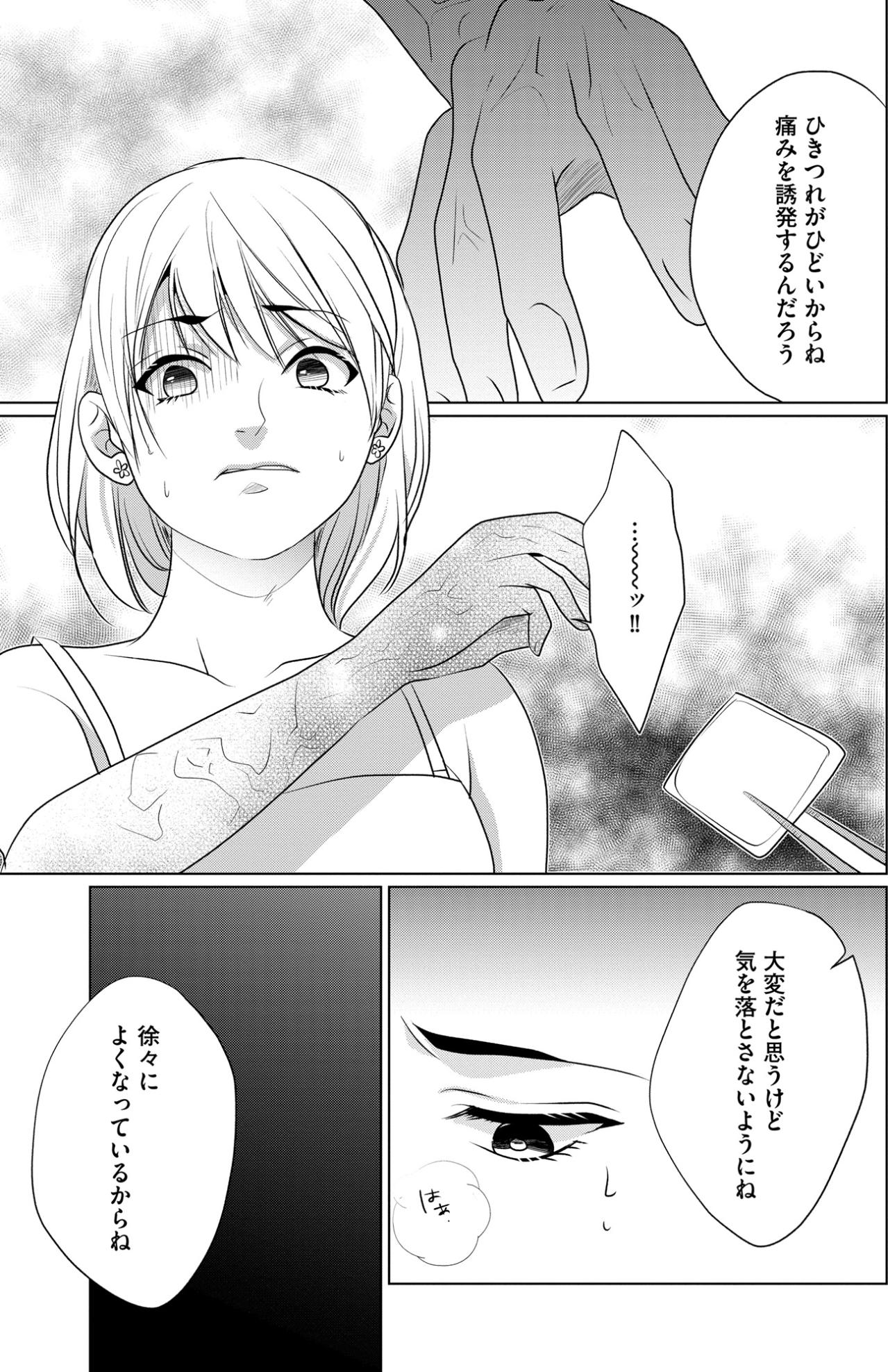「カバーメイクをとって見せて」診察室で晒す無残な腕。痛みが私に与える、歪んだ生きる力【顔を盗られた女 ～この世から「私」がいなくなる～#31】（画像6）