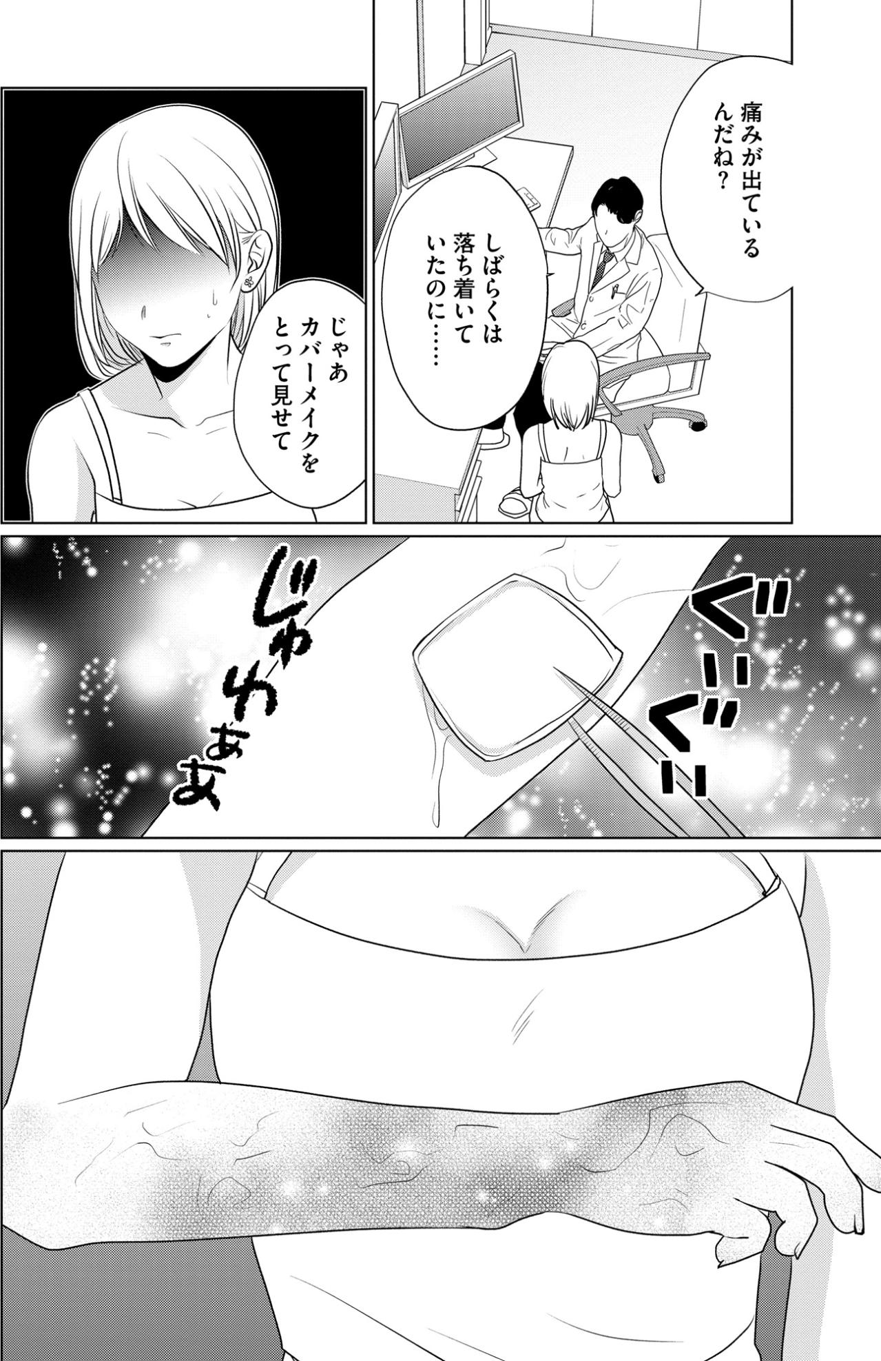 「カバーメイクをとって見せて」診察室で晒す無残な腕。痛みが私に与える、歪んだ生きる力【顔を盗られた女 ～この世から「私」がいなくなる～#31】（画像5）