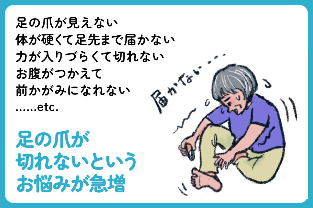 小指の爪が小さい人は要注意？夏前に始めたい巻き爪・足トラブル対策【足連載／第９歩】（画像3）