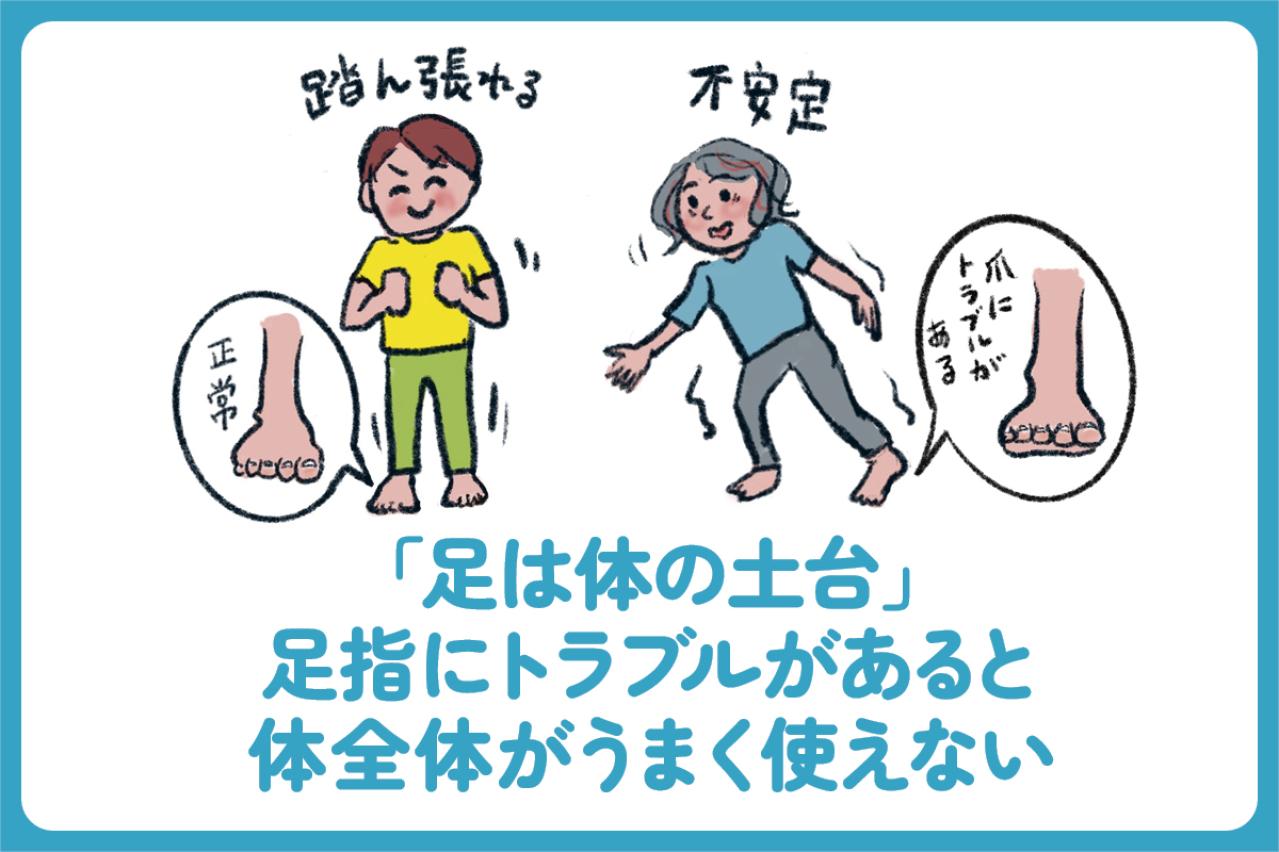 小指の爪が小さい人は要注意？夏前に始めたい巻き爪・足トラブル対策【足連載／第９歩】（画像4）