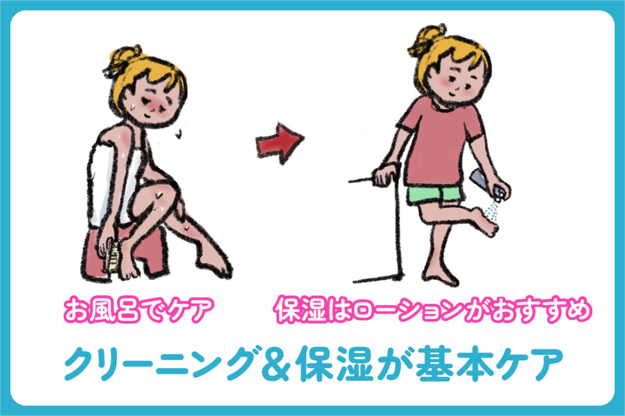 巻き爪・ウオノメ・かかとのひび割れ……足トラブル別セルフケア術【足連載／第10歩・後編】（画像3）