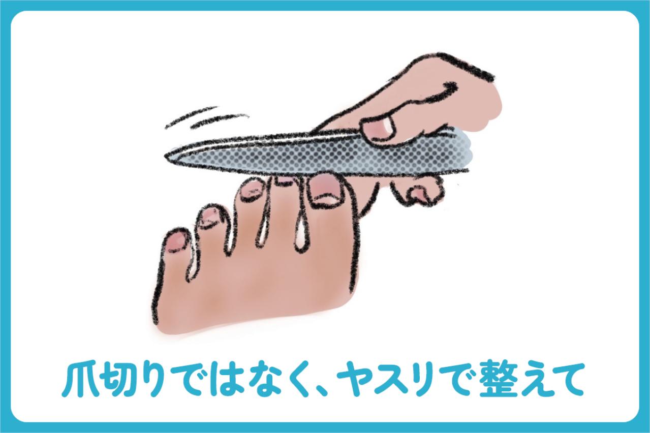 タイプ別で知りたい！足と爪を守る毎日のケアと履き物選び【足連載／第10歩・前編】（画像2）
